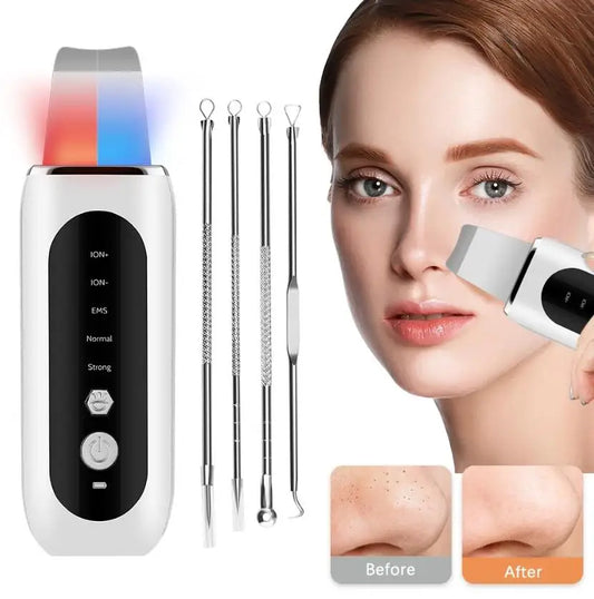 Ultrasonic Skin Scrubber, Peeling, Shovel, Blackhead Remover